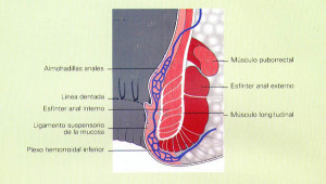 hemorroides diagrama